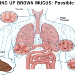 coughing up brown mucus